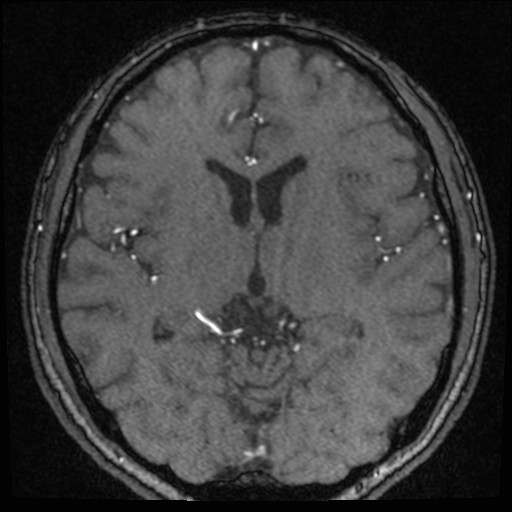 Click on the Serie image to view the images of VILLANUEVA, WILLIAM A.